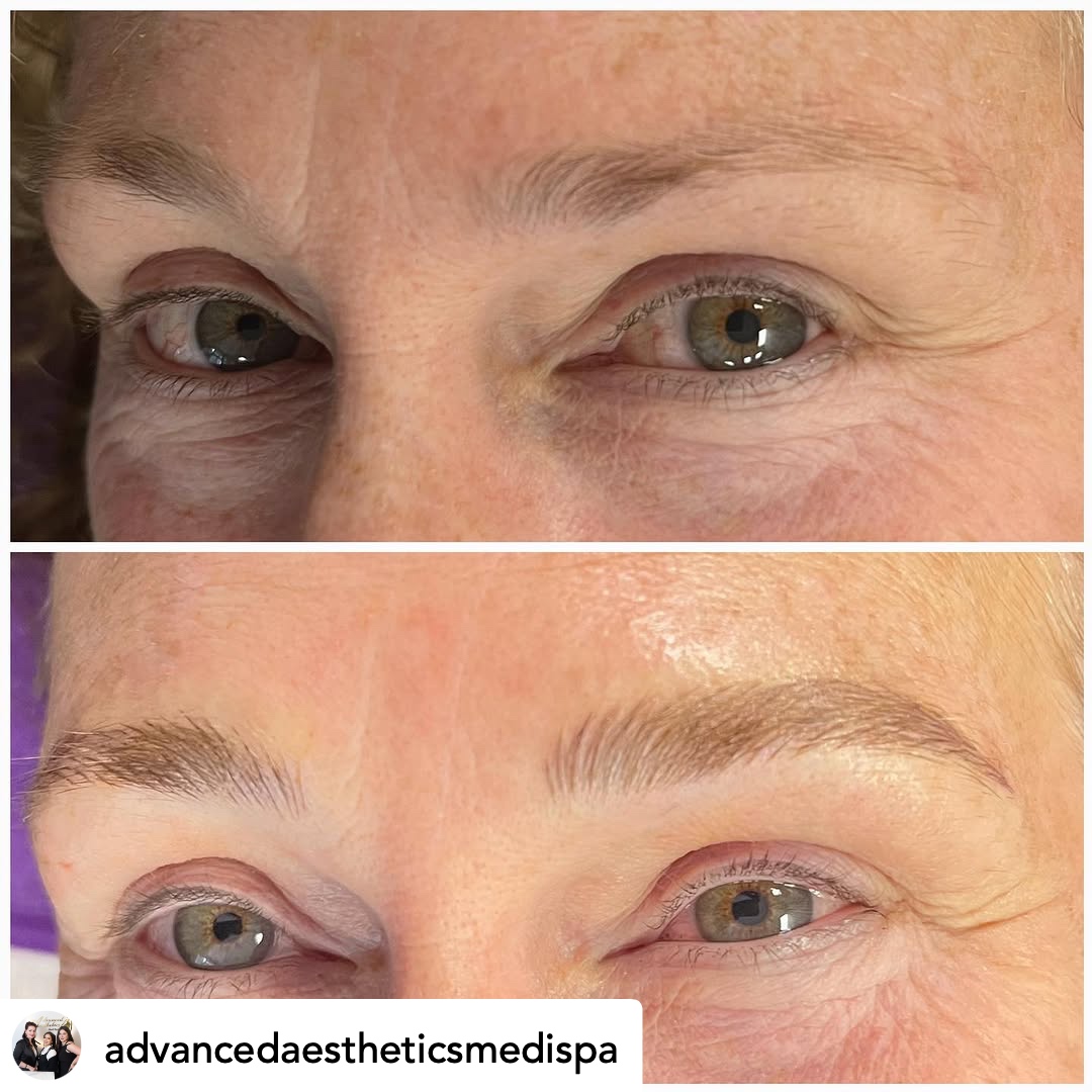 Microblading before and after — natural brow restoration
