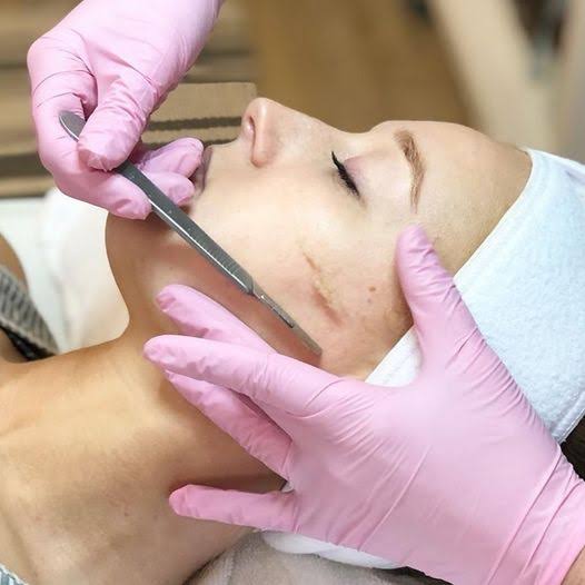 Dermaplaning facial exfoliation treatment being performed