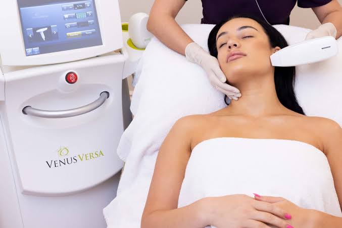 Radio frequency skin resurfacing treatment in progress