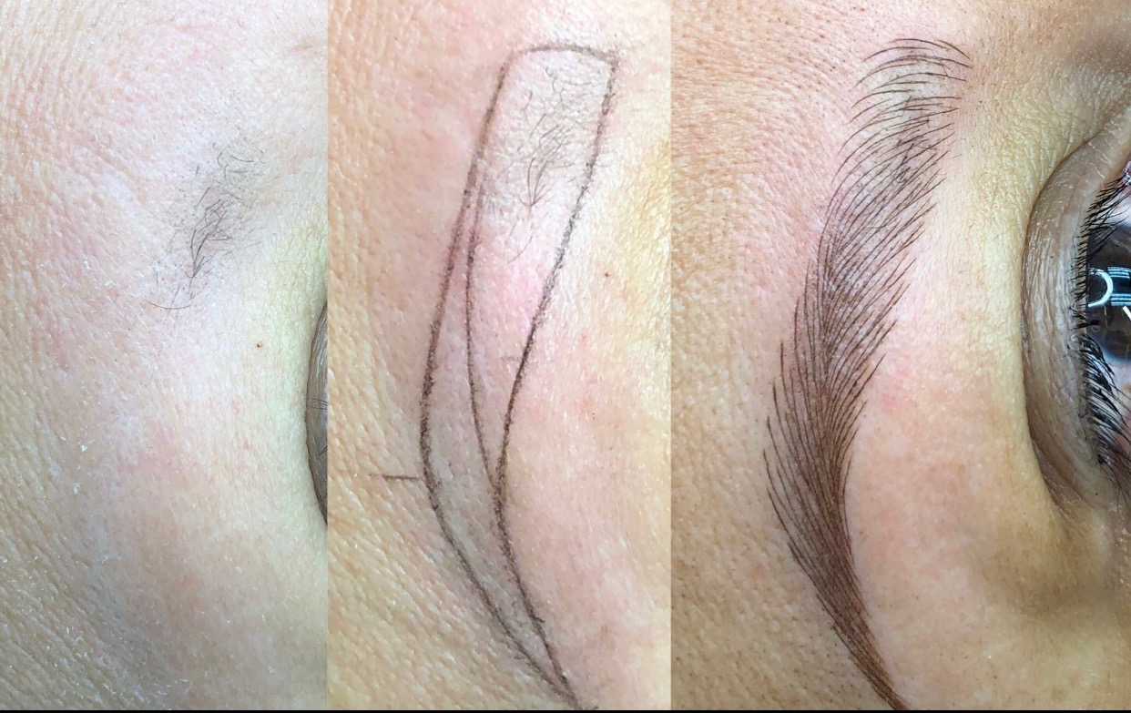 Before Treatment