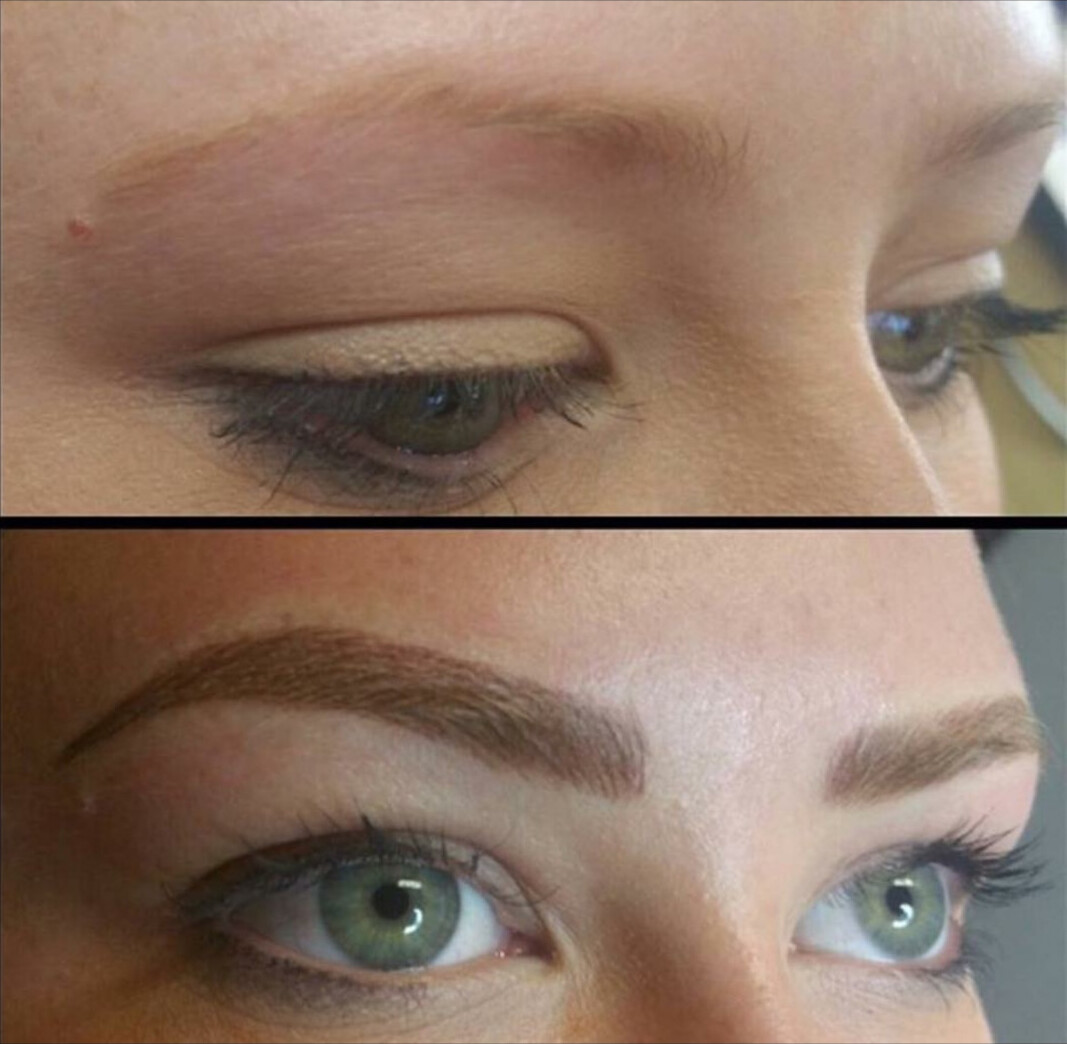 After Treatment