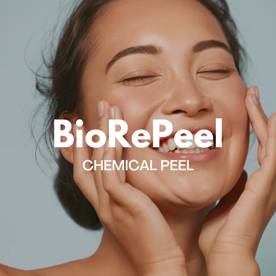 BioRePeel chemical peel treatment