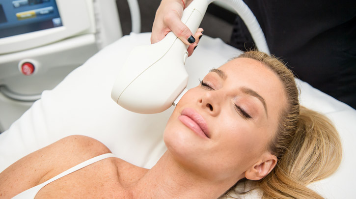 Venus Versa IPL photofacial treatment