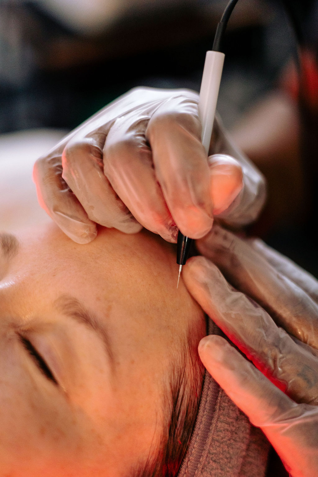 Skin Classic treatment in progress