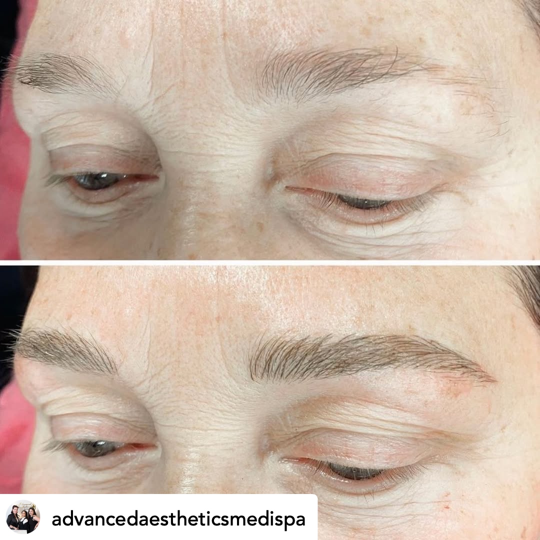 Microblading before and after — symmetrical brows
