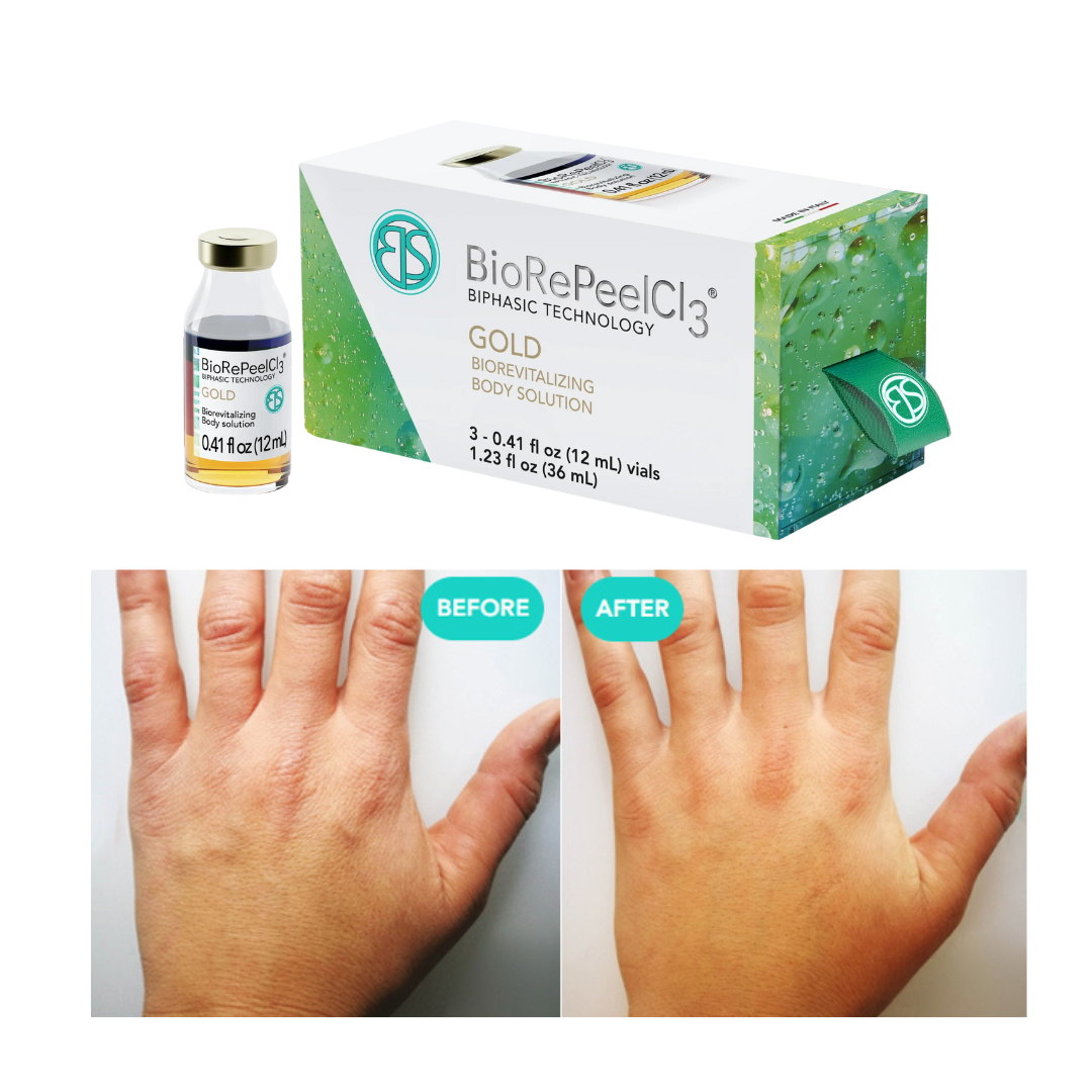 BioRePeelCl3 GOLD body solution with before and after hand rejuvenation results