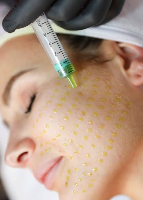 Lipophilic phase of BioRePeel applied to skin