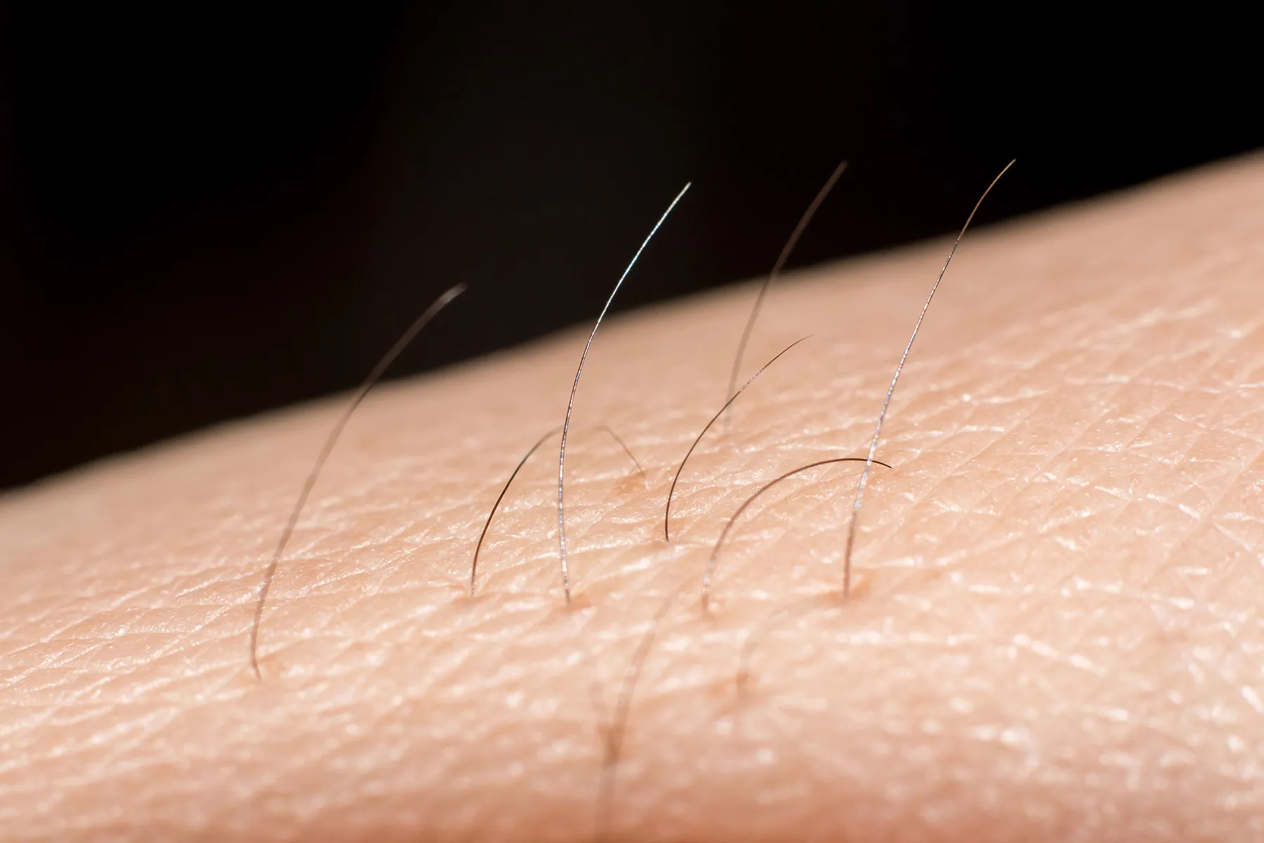 Unwanted Hair